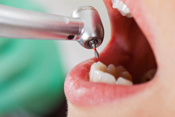 Best Dentist for Tooth Abscess  in Blue Mound, IL
